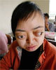 Vietnamese Delegation in U.S. to Sue Chemical Companies for Ongoing Effects of Agent Orange