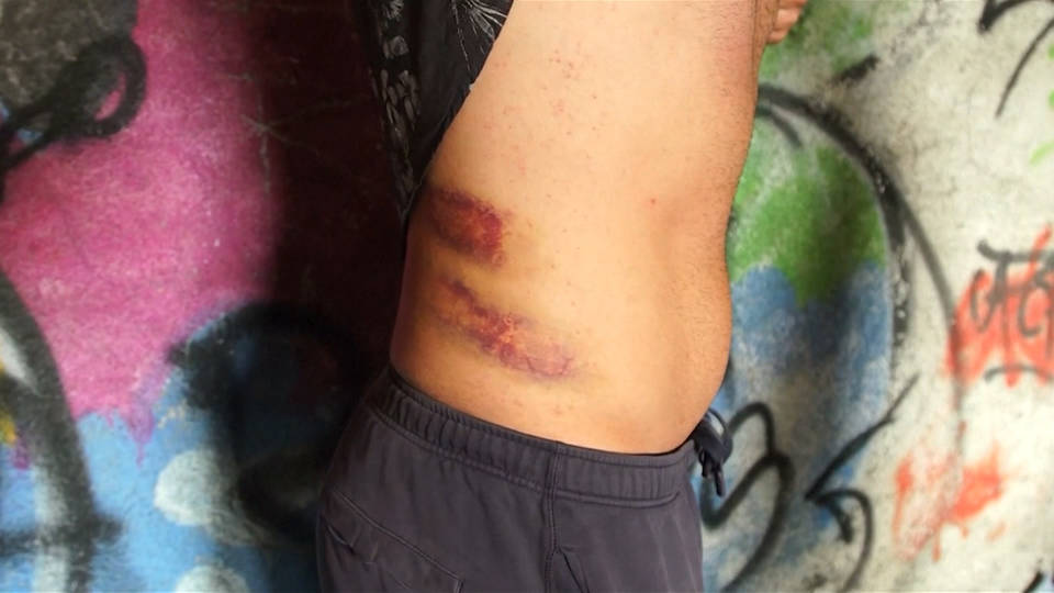 H5 croatia migrant beating