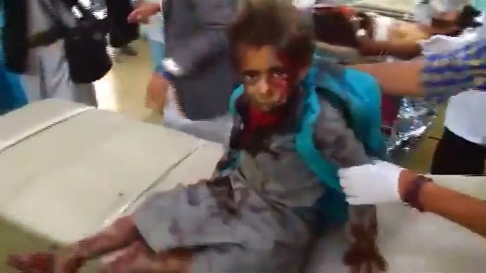 H1 yemen
