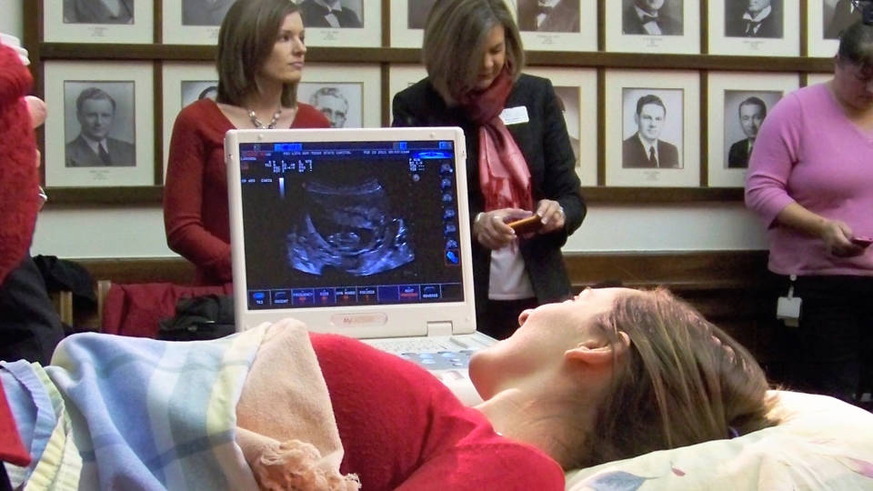 H11 ultrasound ohio gov signs fetal heartbeat anti abortion bill0