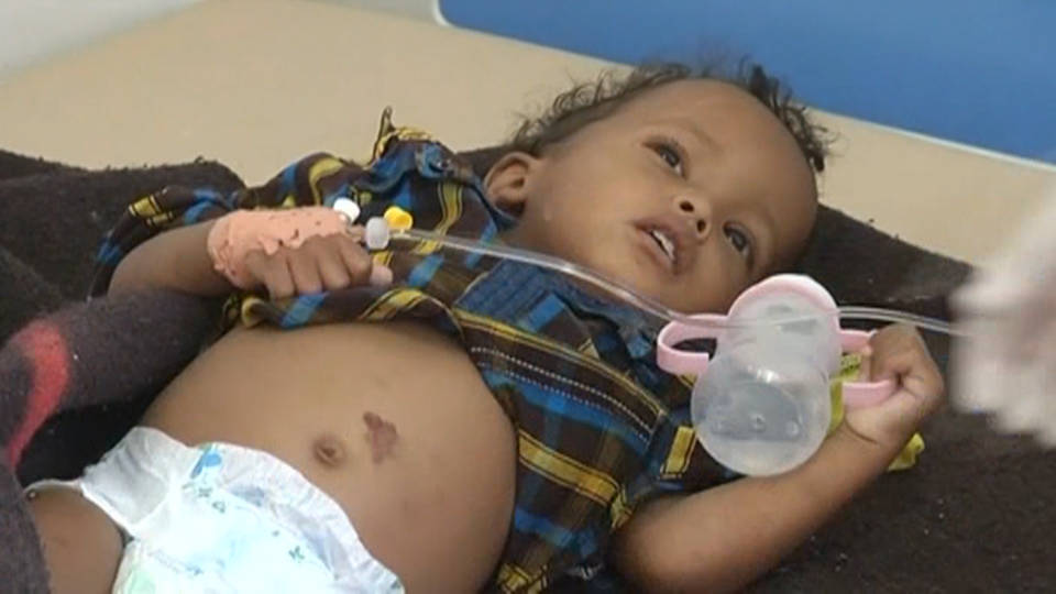 H3 yemen cholera f