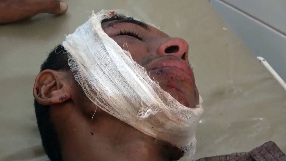 H3 yemen airstrike victim