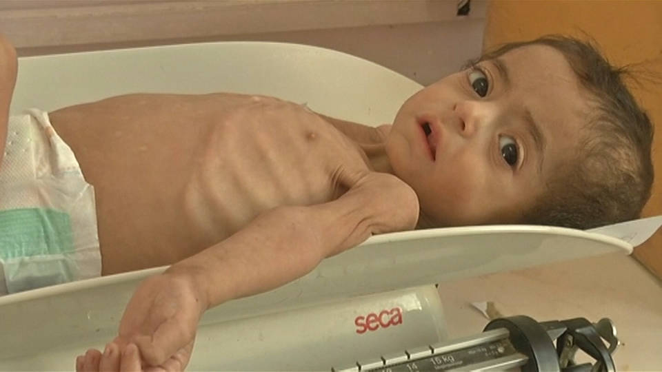 H6 yemen starvation