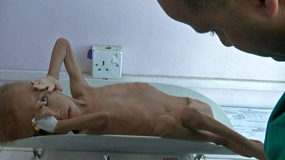 H13 yemen