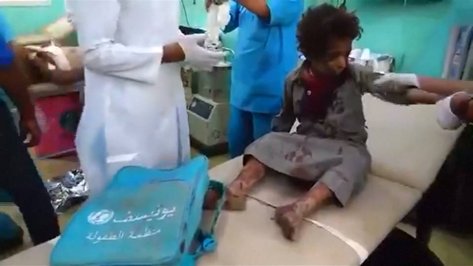 H7 yemeni bus bombing victim