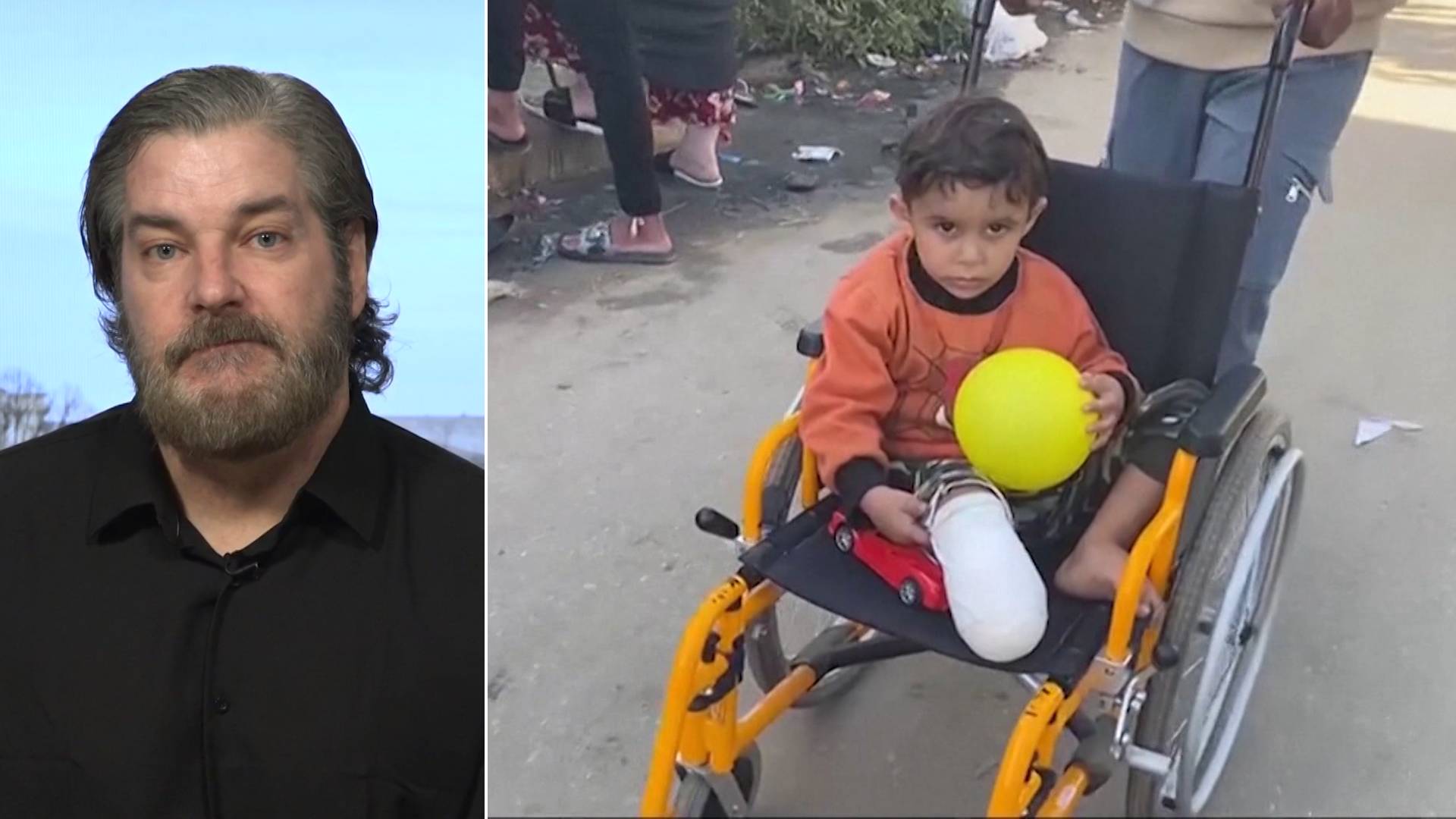 “Absolutely Unimaginable”: Children in Gaza Face Amputations Without