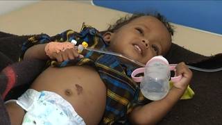 Yemen-cholera.jpg