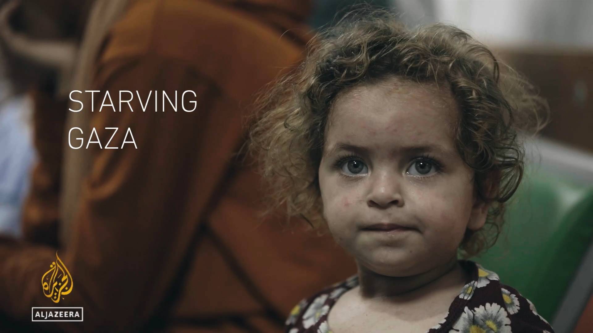 The Power Of One Photo The Story Behind The Starving Gaza Baby - unc73jy
