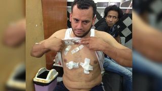 Morsi protestor attack2