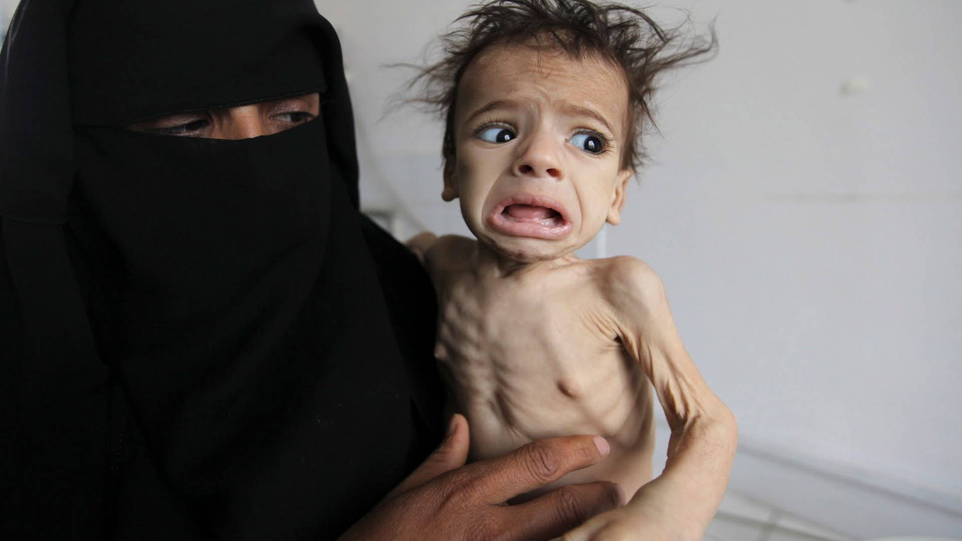 Image result for yemen famine