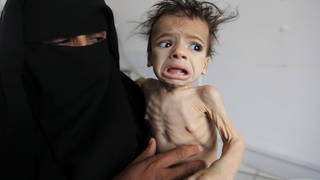 _S2_Yemen-famine.jpg